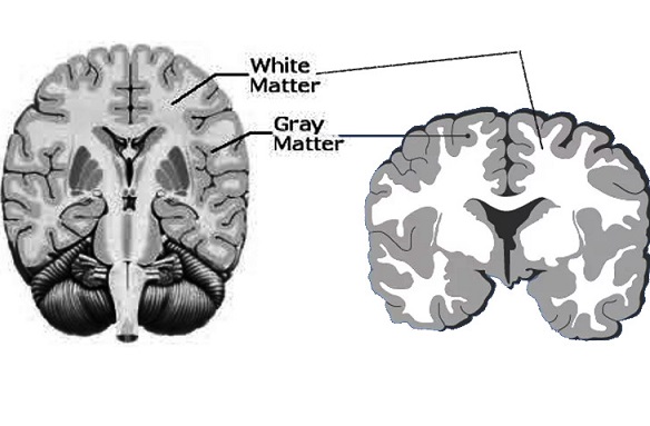 Enhanced White Matter Microstructure in Tai Chi Practitioners to Reduce ...